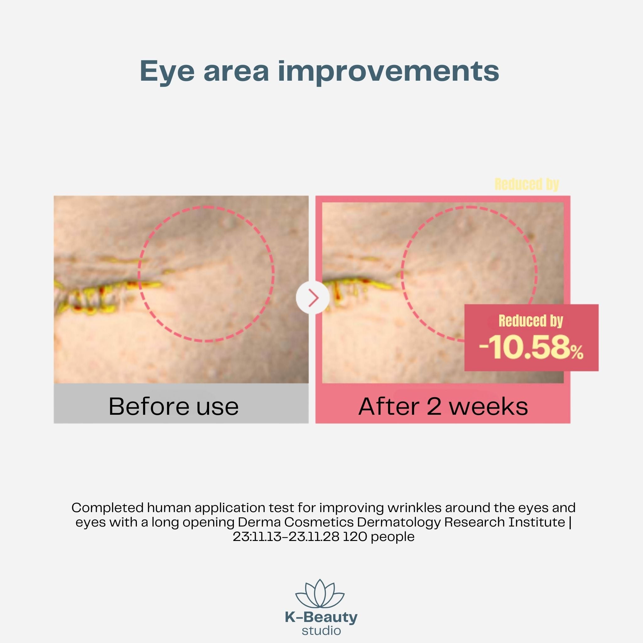 Torriden Cellmazing Firming Eye Cream Results