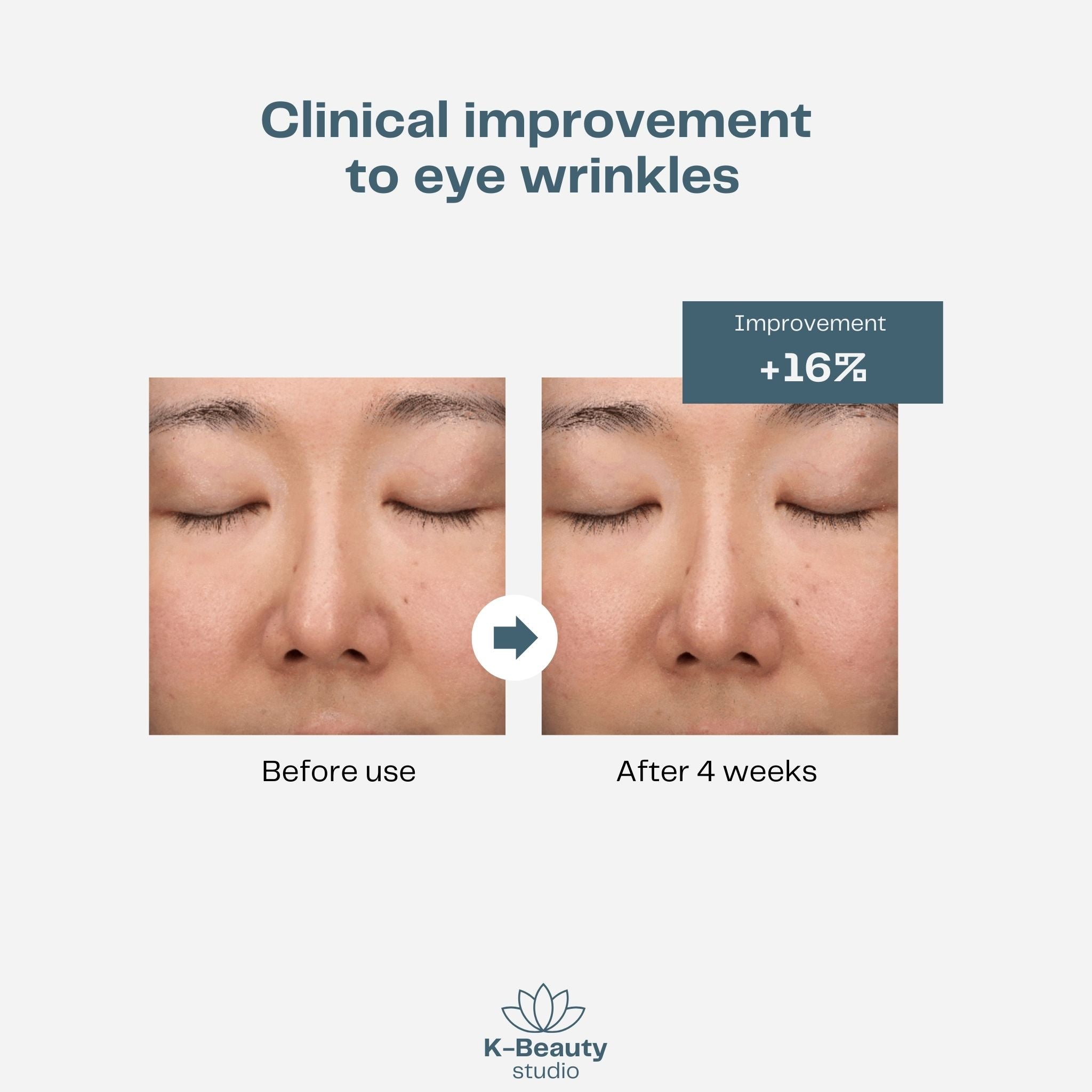 Beauty of Joseon Revive Eye Serum Results