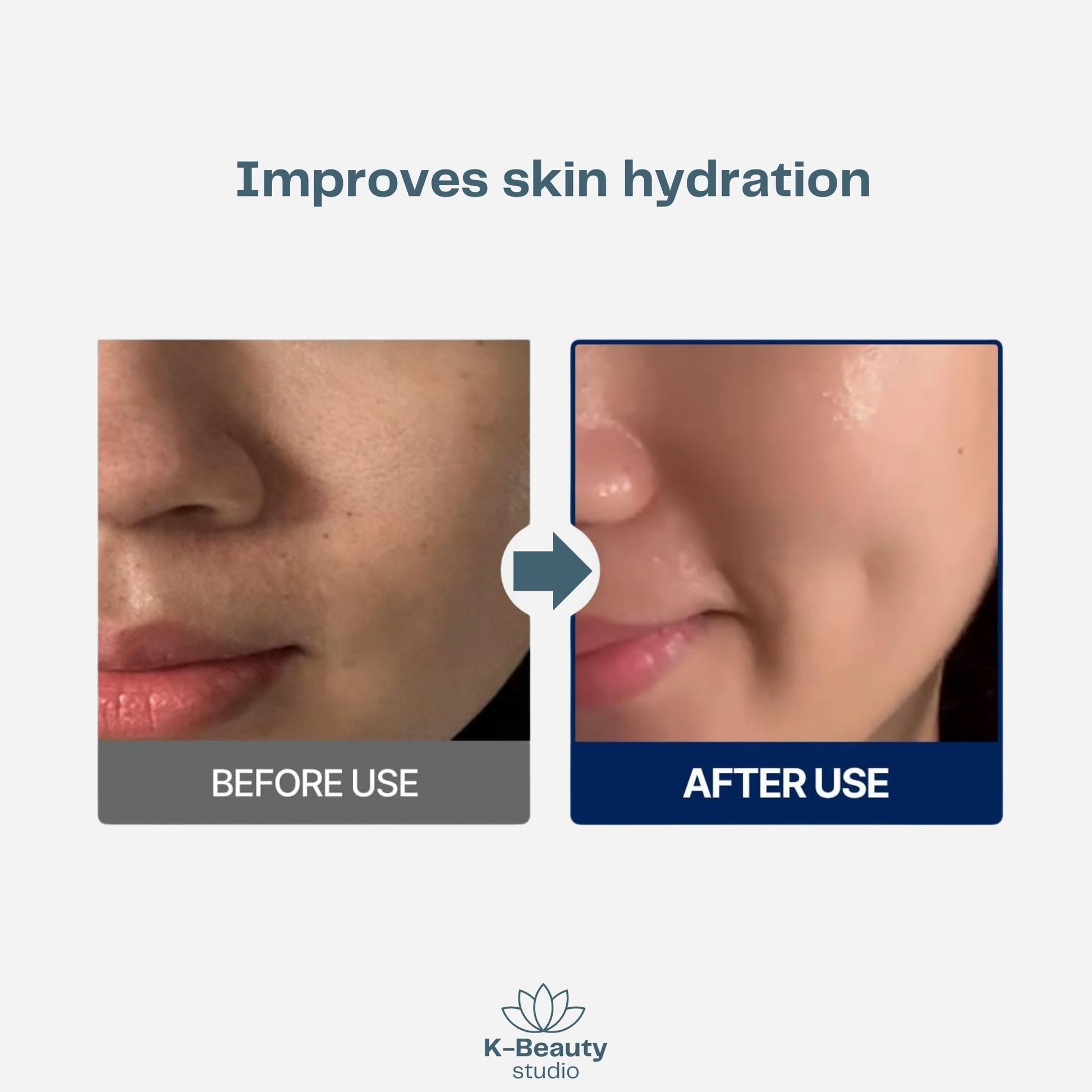 Torriden Dive In Hyaluronic Acid Mask Results